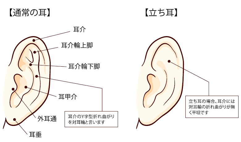 立ち耳（耳介変形）（保険診療）｜東京八丁堀皮膚科・形成外科【公式】｜保険診療取扱